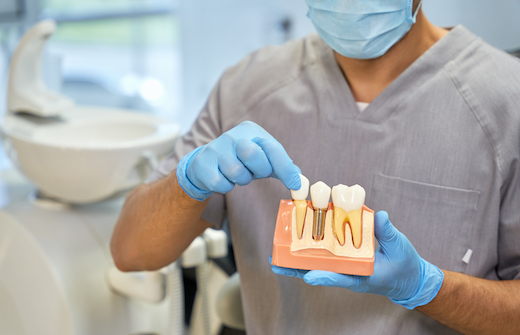 Fragment photo of a medical worker in mask and gloves demonstrating how dental implants work